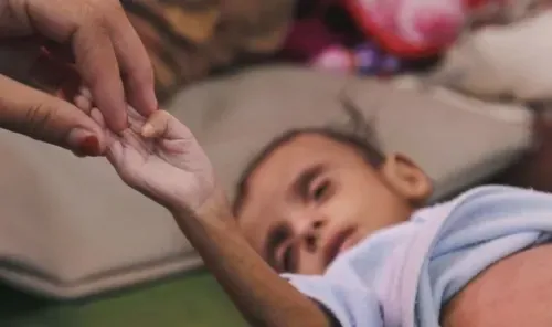 وفاة 21 طفلاً بسبب الجوع والاتحاد الأوروبي يحث إسرائيل على وقف استهداف المدنيين في نقاط المساعدات