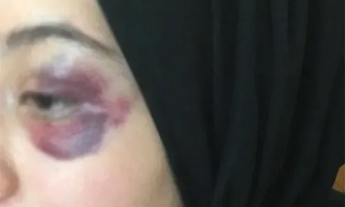 المحكمة تأمر بحبس بحريني بتهمة الاعتداء على زوجته