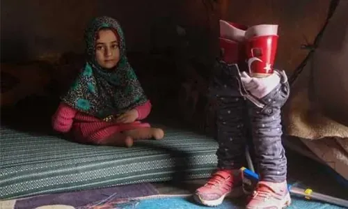 ولدت بلا ساقين، لكنها لم تتوقف عن المحاولة