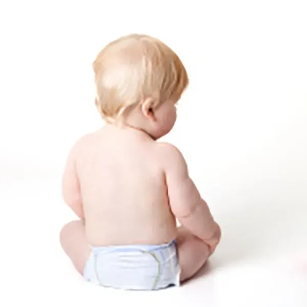Heartless mother burns her 15-month old daughter\'s legs and genitals.
