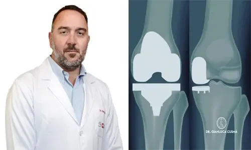 إجراء جراحة نادرة للركبة في مستشفى رويال البحرين