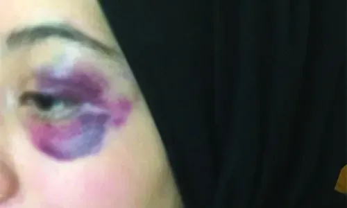السجن لرجل بحريني اعتدى بوحشية على زوجته في الطريق
