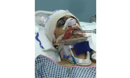 إصابة مراهق بحريني في تبادل لإطلاق النار