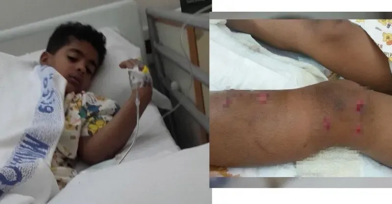 Breaking News: Young boy attacked by stray dogs in Sanabis